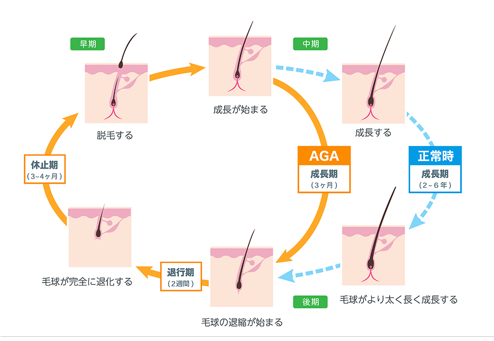 ヘアサイクル